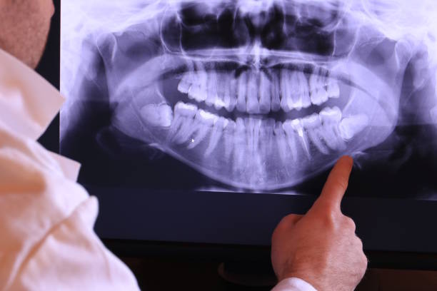 Best Emergency Gum Pain Relief  in North Vacherie, LA