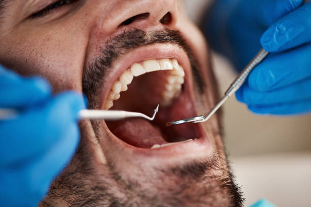 Best Teeth Whitening  in North Vacherie, LA